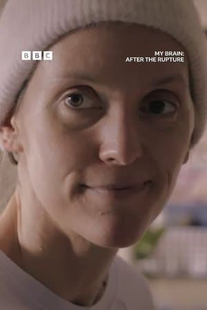 My Brain: After the Rupture My Brain: After the Rupture